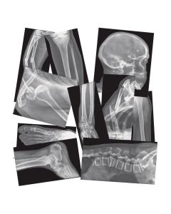 Roylco Broken Bones X-Rays 15pk. A great addition to STEM. R5914
